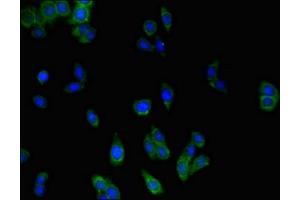 Immunofluorescent analysis of HepG2 cells using ABIN7159344 at dilution of 1:100 and Alexa Fluor 488-congugated AffiniPure Goat Anti-Rabbit IgG(H+L) (MLC1 Antikörper  (AA 1-49))