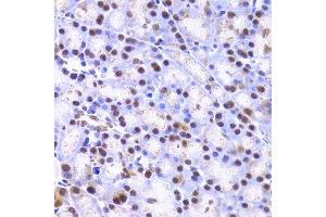 Immunohistochemistry of paraffin-embedded rat pancreas using XRCC4 antibody at dilution of 1:200 (400x lens).