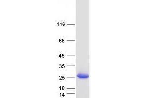 Western Blotting (WB) image for DCMP Deaminase (DCTD) (Transcript Variant 1) protein (Myc-DYKDDDDK Tag) (ABIN2719252)