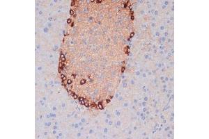 Immunohistochemistry (IHC) image for anti-ATG5 Autophagy Related 5 (ATG5) (AA 28-275) antibody (ABIN6137264)