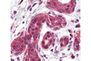 Immunohistochemistry (IHC) image for anti-Snail Family Zinc Finger 2 (SNAI2) (AA 98-129) antibody (ABIN3032658)