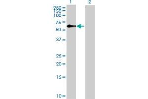 Western Blot analysis of ZFP3 expression in transfected 293T cell line by ZFP3 MaxPab polyclonal antibody. (Zinc Finger Protein 3 Homolog (ZFP3) (AA 1-502) Antikörper)