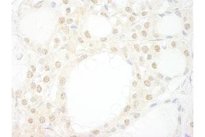 Immunohistochemistry (IHC) image for anti-WD Repeat Domain 20 (WDR20) (AA 450-500) antibody (ABIN7448862) (WDR20 Antikörper  (AA 450-500))