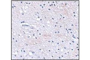 Immunohistochemical staining of human brain tissue using AP30768PU-N at 2. (FBXL20 Antikörper  (C-Term))