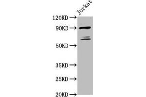 Western Blot Positive WB detected in: Jurkat whole cell lysate All lanes: TAX1BP1 antibody at 5. (TAX1BP1 Antikörper  (AA 592-713))