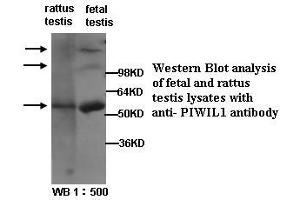 Image no. 1 for anti-Piwi-Like 1 (PIWIL1) (Internal Region) antibody (ABIN790869) (PIWIL1 Antikörper  (Internal Region))