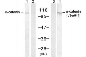 Western blot analysis of extract from A431 cells, untreated or treated with EGF (200ng/ml, 30min), using α-catenin (Ab-641) antibody (E021330, Lane 1 and 2) and α-catenin (Phospho-Ser641) antibody (E011330, Lane 3 and 4). (CTNNA1 Antikörper  (pSer641))