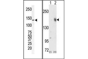 (LEFT)Western blot analysis of anti-ErbB2 Pab in SKBR-3 cell lysate. (ErbB2/Her2 Antikörper  (N-Term))