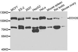 Western blot analysis of extracts of various cell lines, using DDX20 antibody. (DDX20 Antikörper)