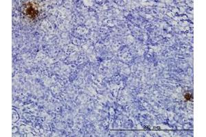 Image no. 3 for anti-Tissue Factor Pathway Inhibitor 2 (TFPI2) (AA 1-236) antibody (ABIN599020) (TFPI2 Antikörper  (AA 1-236))