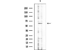 Western blot analysis of lysates from Mouse testis, using XYLB Mouse Monoclonal Antibody at 1/1000 dilution.