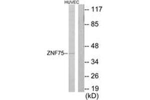 Western blot analysis of extracts from HuvEc cells, using ZNF75 Antibody. (ZNF75 Antikörper  (AA 296-345))