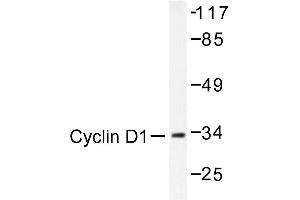 Image no. 1 for anti-Cyclin D1 (CCND1) antibody (ABIN272112) (Cyclin D1 Antikörper)