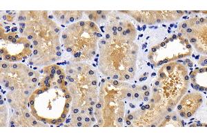 Detection of BAD in Human Kidney Tissue using Polyclonal Antibody to Bcl2 Associated Death Promoter (BAD)