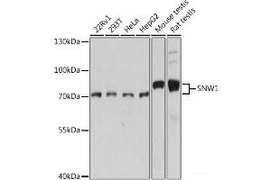 Western blot analysis of extracts of various cell lines using SNW1 Polyclonal Antibody at dilution of 1:1000. (SNW1 Antikörper)