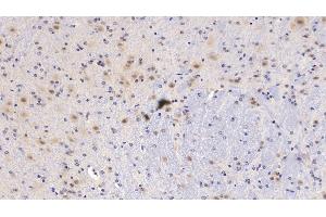 Immunohistochemistry (IHC) image for anti-serpin Peptidase Inhibitor, Clade F (Alpha-2 Antiplasmin, Pigment Epithelium Derived Factor), Member 1 (SERPINF1) (AA 19-417) antibody (ABIN7428680)