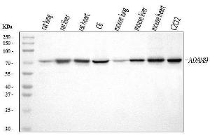Western blot analysis of ADAM9 using anti-ADAM9 antibody (ABIN7601124). (ADAM9 Antikörper  (AA 29-307))