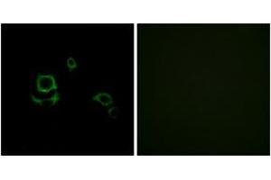 Immunofluorescence analysis of HuvEc cells, using F13B Antibody. (F13B Antikörper  (AA 61-110))