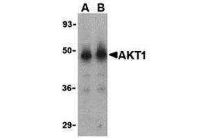 Western Blotting (WB) image for anti-V-Akt Murine Thymoma Viral Oncogene Homolog 1 (AKT1) (N-Term) antibody (ABIN1031225) (AKT1 Antikörper  (N-Term))