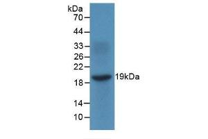 Western blot analysis of recombinant Human MIg. (CXCL9 Antikörper)