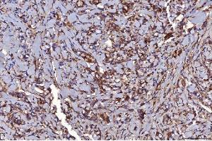 IHC analysis of HGS using anti-HGS antibody (ABIN7601207).