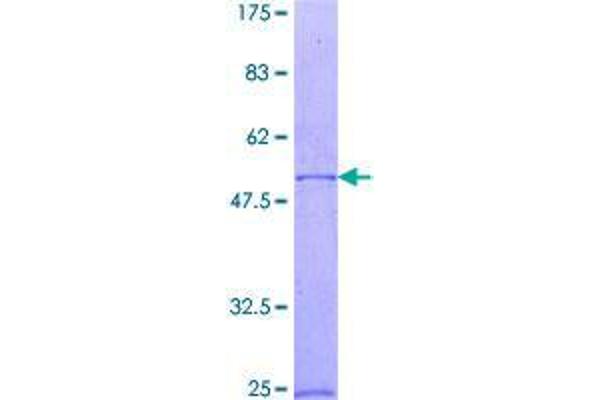 RAB23 Protein (AA 1-237) (GST tag)