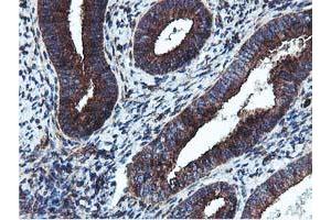 Immunohistochemical staining of paraffin-embedded Human endometrium tissue using anti-EPN2 mouse monoclonal antibody. (Epsin 2 Antikörper)