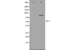 Western blot analysis of Hepg2 whole cell lysates, using CLCN5 Antibody. (Chloride Channel 5 Antikörper  (Internal Region))