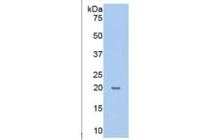 WB of Protein Standard: different control antibodies  against Highly purified E. (PPIB ELISA Kit)