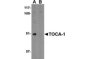 Western Blotting (WB) image for anti-Formin Binding Protein 1-Like (FNBP1L) (C-Term) antibody (ABIN1030761)