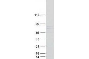 Western Blotting (WB) image for Tetratricopeptide Repeat Domain 8 (TTC8) (Transcript Variant 2) protein (Myc-DYKDDDDK Tag) (ABIN2734495)