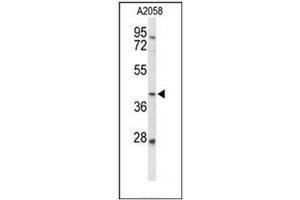 Western blot analysis of FUT3 Antibody (C-term) in A2058 cell line lysates (35ug/lane). (FUT3 Antikörper  (C-Term))