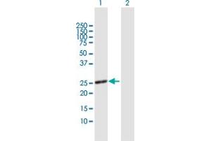 Western Blot analysis of PGLS expression in transfected 293T cell line by PGLS MaxPab polyclonal antibody. (PGLS Antikörper  (AA 1-258))