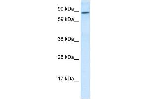 WB Suggested Anti-TCF4 Antibody Titration:  0. (TCF4 Antikörper  (N-Term))