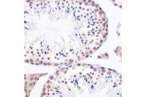 Immunohistochemistry of paraffin-embedded mouse testis using GMNN Rabbit pAb (ABIN6129382, ABIN6141186, ABIN6141187 and ABIN6220942) at dilution of 1:100 (40x lens).