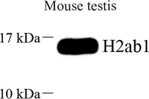 Western blot analysis of H2ab1 (ABIN7074228) at dilution of 1: 2000 (H2-AB1 Antikörper)