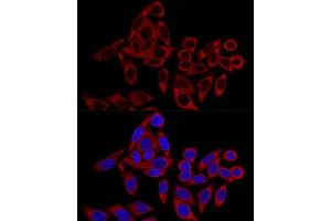 Confocal immunofluorescence analysis of HeLa cells using RRBP1 Polyclonal Antibody (ABIN6132872, ABIN6147259, ABIN6147260 and ABIN6215844) at dilution of 1:100.