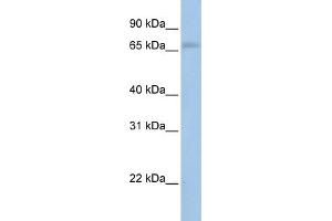 WB Suggested Anti-MAP3K2  Antibody Titration: 0. (MAP3K2 Antikörper  (N-Term))