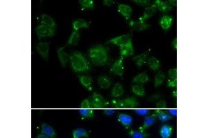 Immunofluorescence analysis of HeLa cells using MAPRE2 Polyclonal Antibody (MAPRE2 Antikörper)