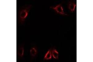 Immunofluorescent analysis of Axin-2 staining in U2OS cells. (AXIN2 Antikörper)