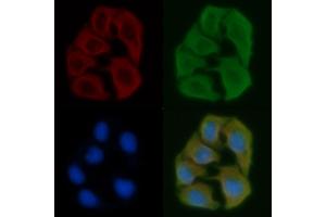 ABIN6257256 and ABIN6275187 staining Hela cells by IF/ICC. (HLA-DOB Antikörper  (N-Term))