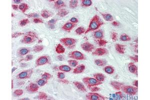 Human Placenta (LIMD1 Antikörper  (N-Term))