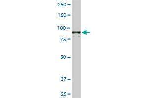 AMPD2 monoclonal antibody (M01), clone 2F5. (AMPD2 Antikörper  (AA 86-185))