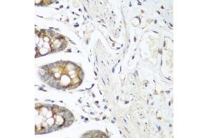 Immunohistochemistry of paraffin-embedded human colon using VEGFR3/FLT4 antibody (ABIN6130780, ABIN6140699, ABIN6140702 and ABIN6221242) at dilution of 1:200 (40x lens). (FLT4 Antikörper  (AA 1174-1363))