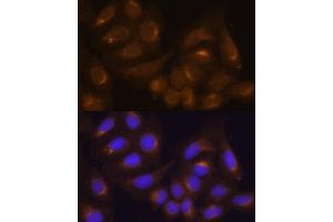 Immunofluorescence analysis of NIH/3T3 cells using Caspase-9 antibody (ABIN6131534, ABIN6137975, ABIN6137977 and ABIN6213766) at dilution of 1:100. (Caspase 9 Antikörper  (AA 1-98))