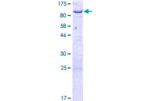 ACSS2 Protein (AA 1-606) (GST tag)