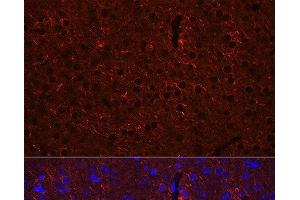 Immunofluorescence analysis of Mouse brain using GAD2 Polyclonal Antibody at dilution of 1:100 (40x lens). (GAD65 Antikörper)
