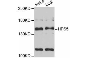 Western blot analysis of extracts of various cell lines, using HPS5 antibody (ABIN5997922) at 1:3000 dilution. (HPS5 Antikörper)