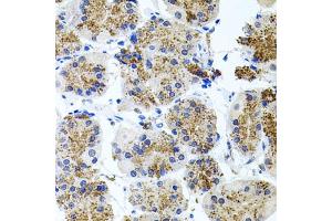 Immunohistochemistry of paraffin-embedded human stomach using SSTR2 antibody (ABIN5971606) at dilution of 1/100 (40x lens).