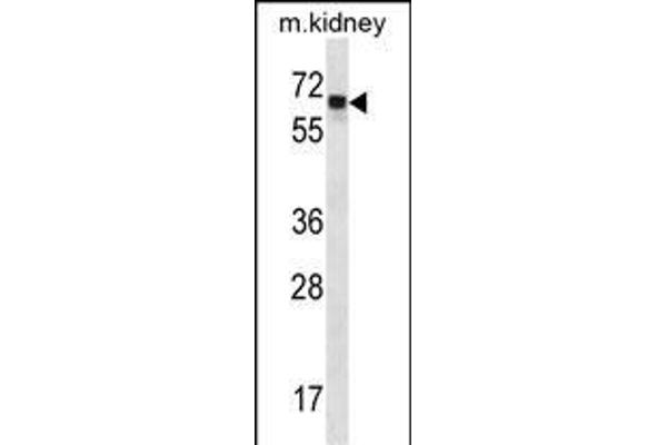 Angiopoietin 2 Antikörper  (C-Term)